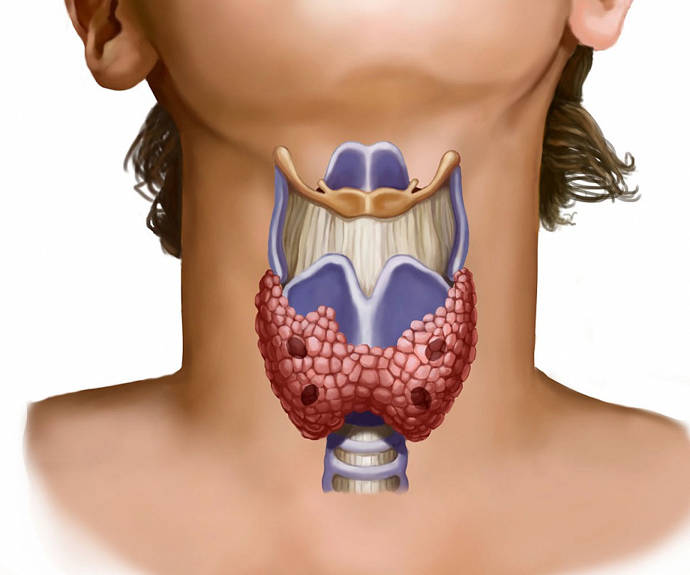 Гормоны щитовидки