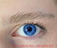 Линзы